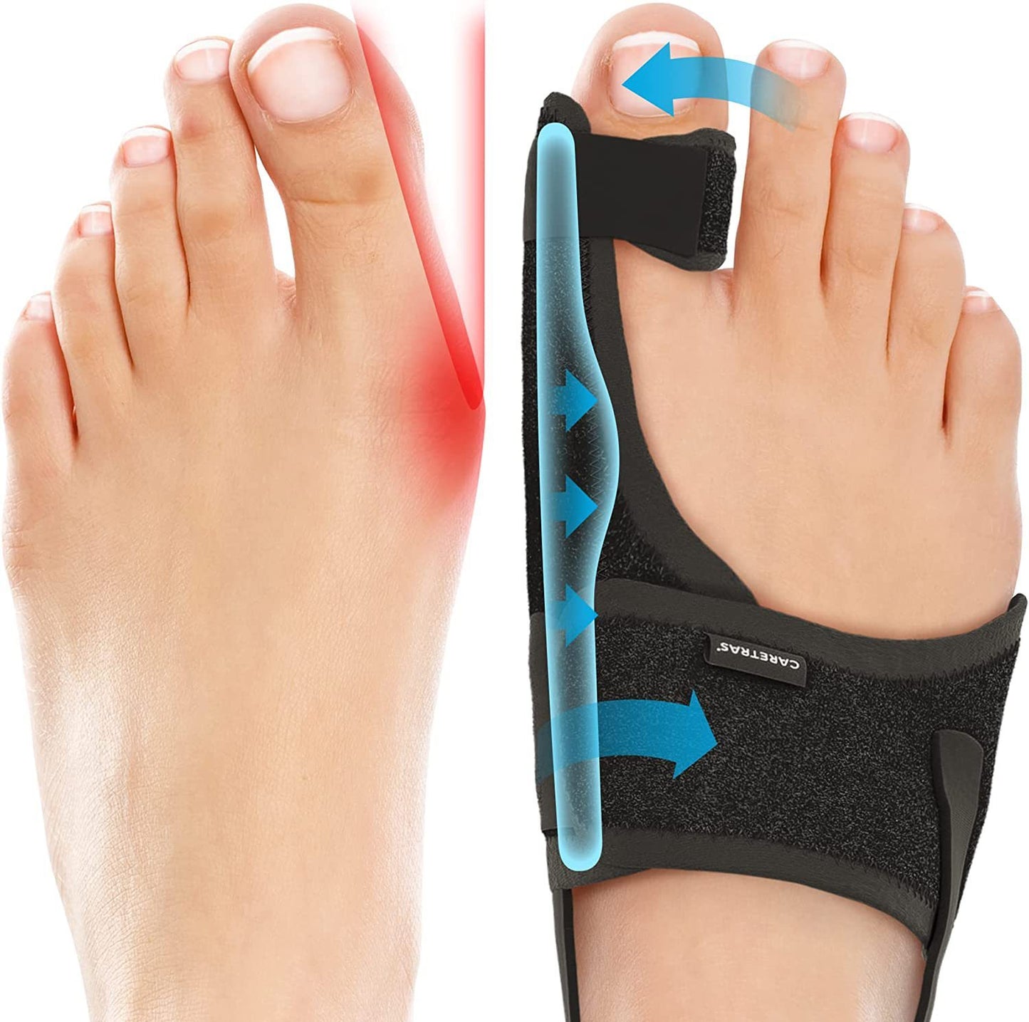 Koçshop Bunion Brace